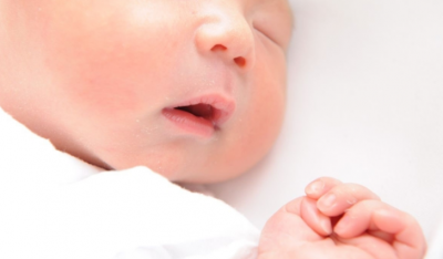 乳児のアトピー　皮脂RNAで早期検出へ